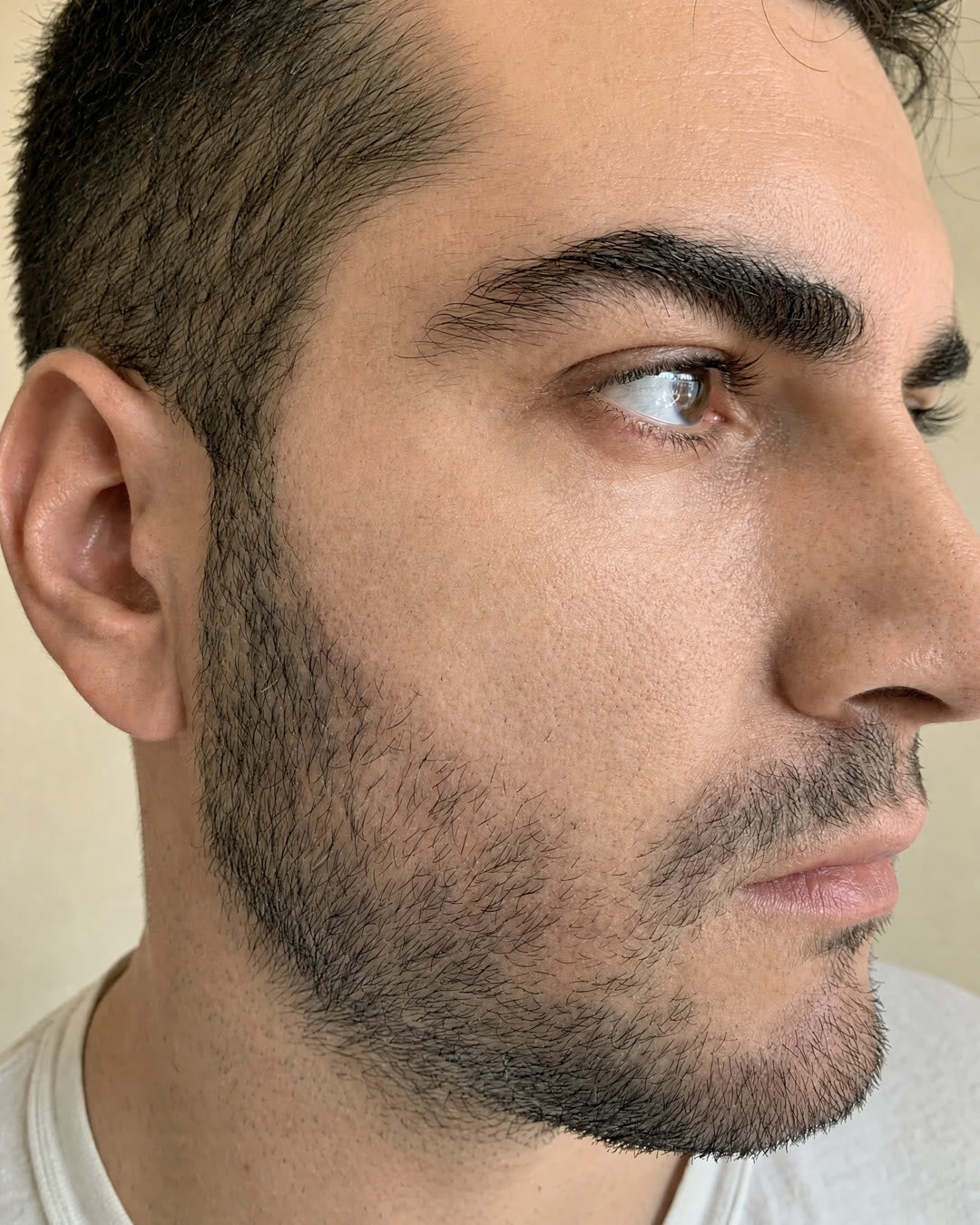 After — Cheek and nose redness