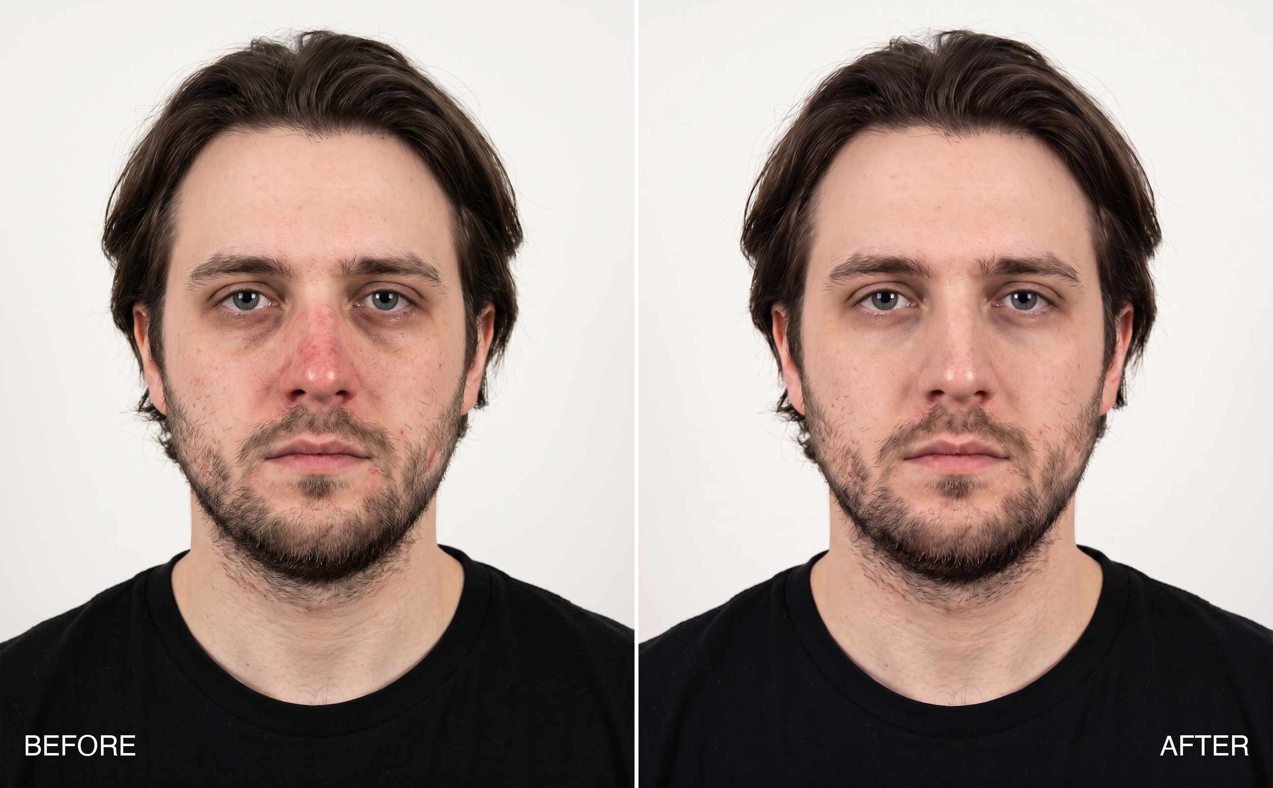 Before and after