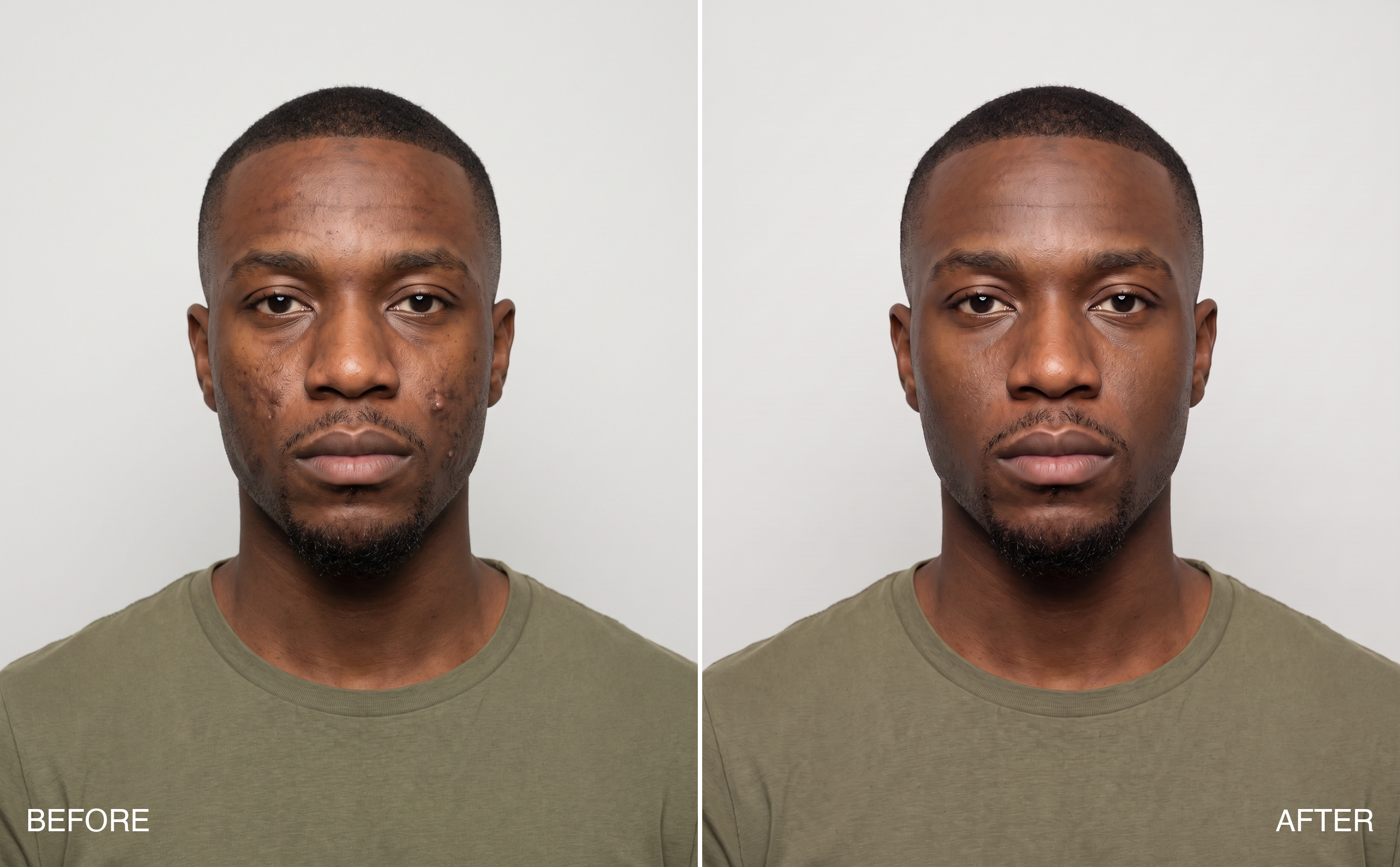Before and after