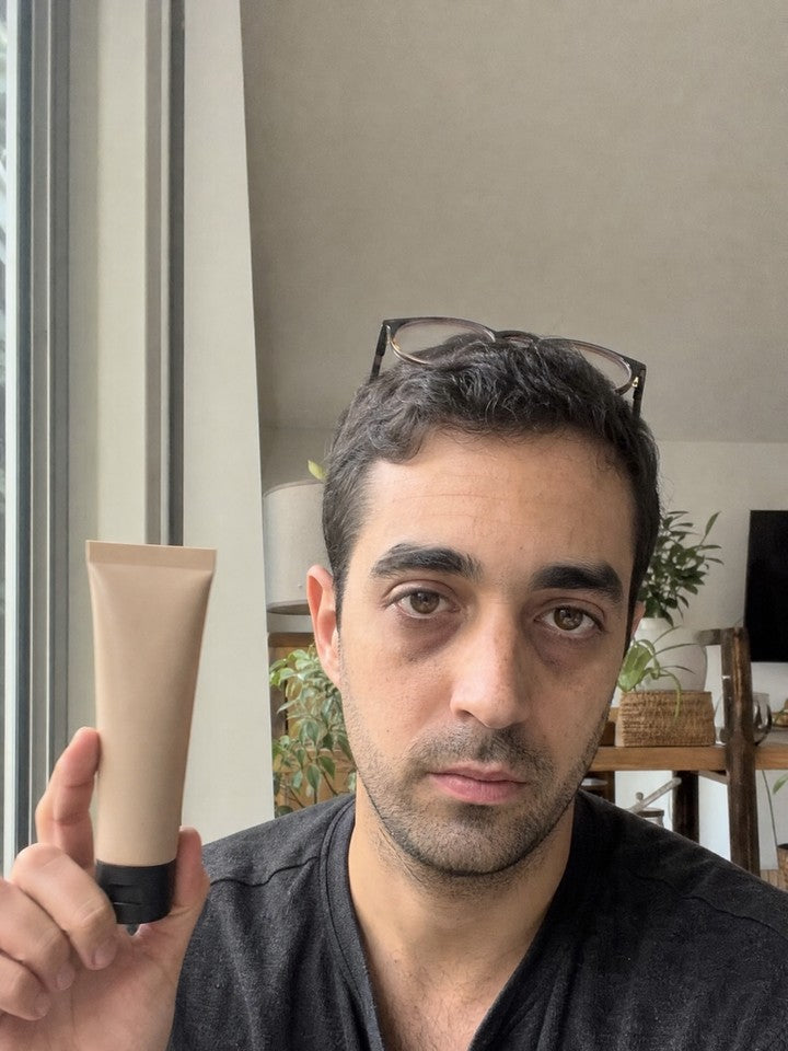 Dark circles